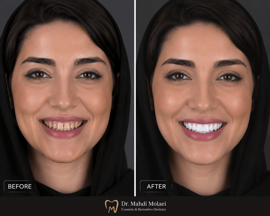 طراحی لبخند دیجیتال